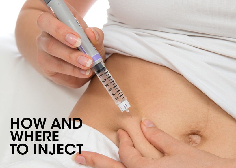 HOW AND WHERE TO INJECT